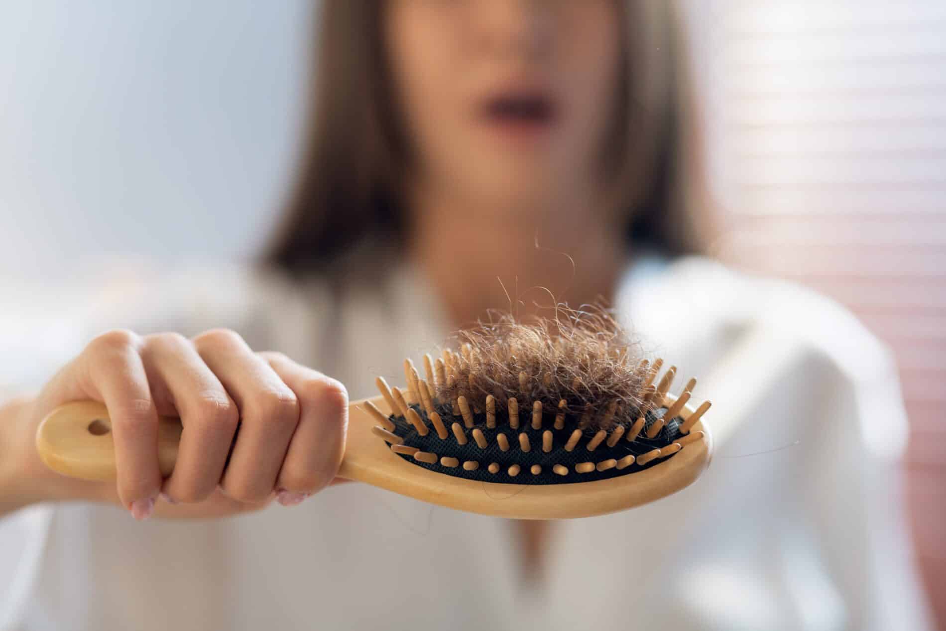 hairloss concept worried woman holding comb full 2023 11 27 05 13 03 utc scaled Why Thyroid and Hair Loss Occur in Dallas- Innovative Health