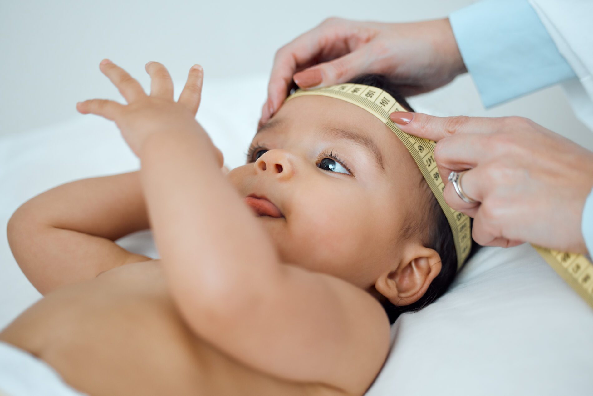 Plagiocephaly: How It Affects On Infants?- Innovative Health