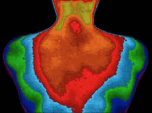 Thermography