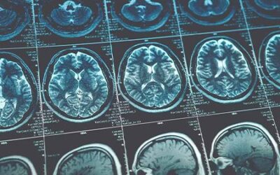 Old Concept, New Application for Neuro Rehab