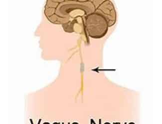 Vagus Nerve