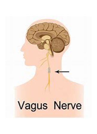Vagus Nerve | Innovative Health & Wellness (214) 972-0302