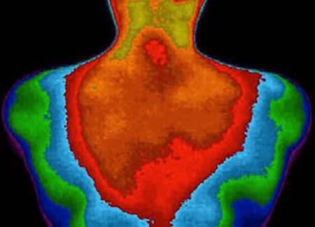 Thermography Dallas