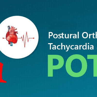 What Is Postural Orthostatic Tachycardia Syndrome (Pots) ?