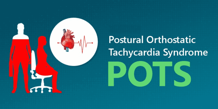 Postural Orthostatic Tachycardia Syndrome