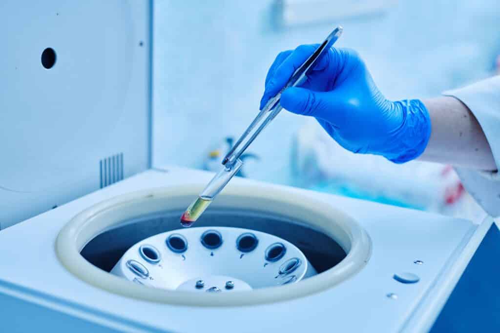 Gloved hand placing a sample tube into a laboratory centrifuge