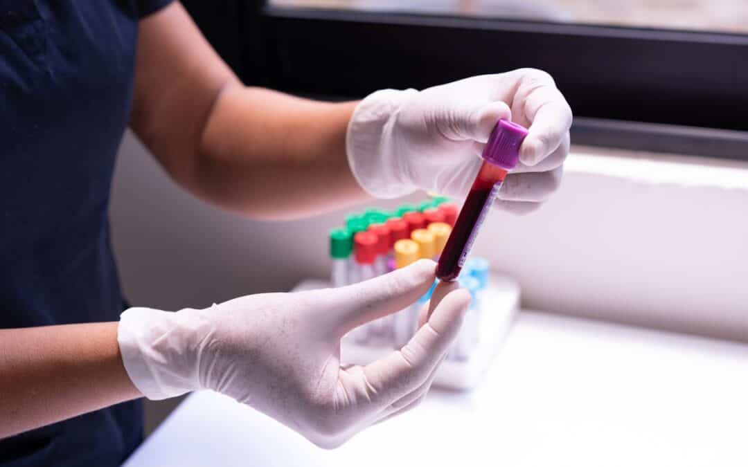 Why Regular Bloodwork Monitoring is Essential for Optimal Health