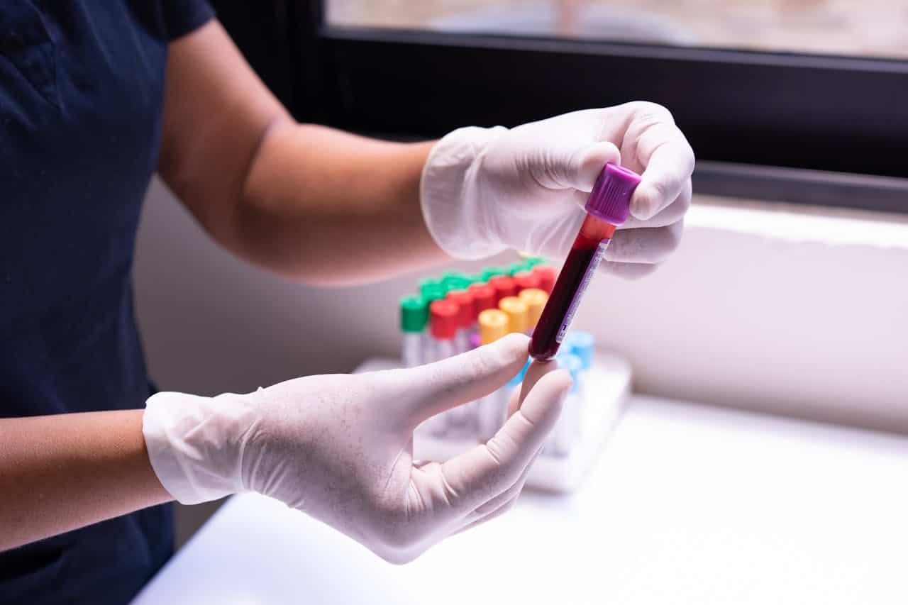 Why Regular Bloodwork Monitoring is Essential for Optimal Health